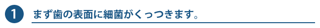 1. まず歯の表面に細菌がくっつきます