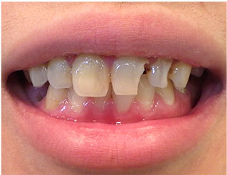 Before