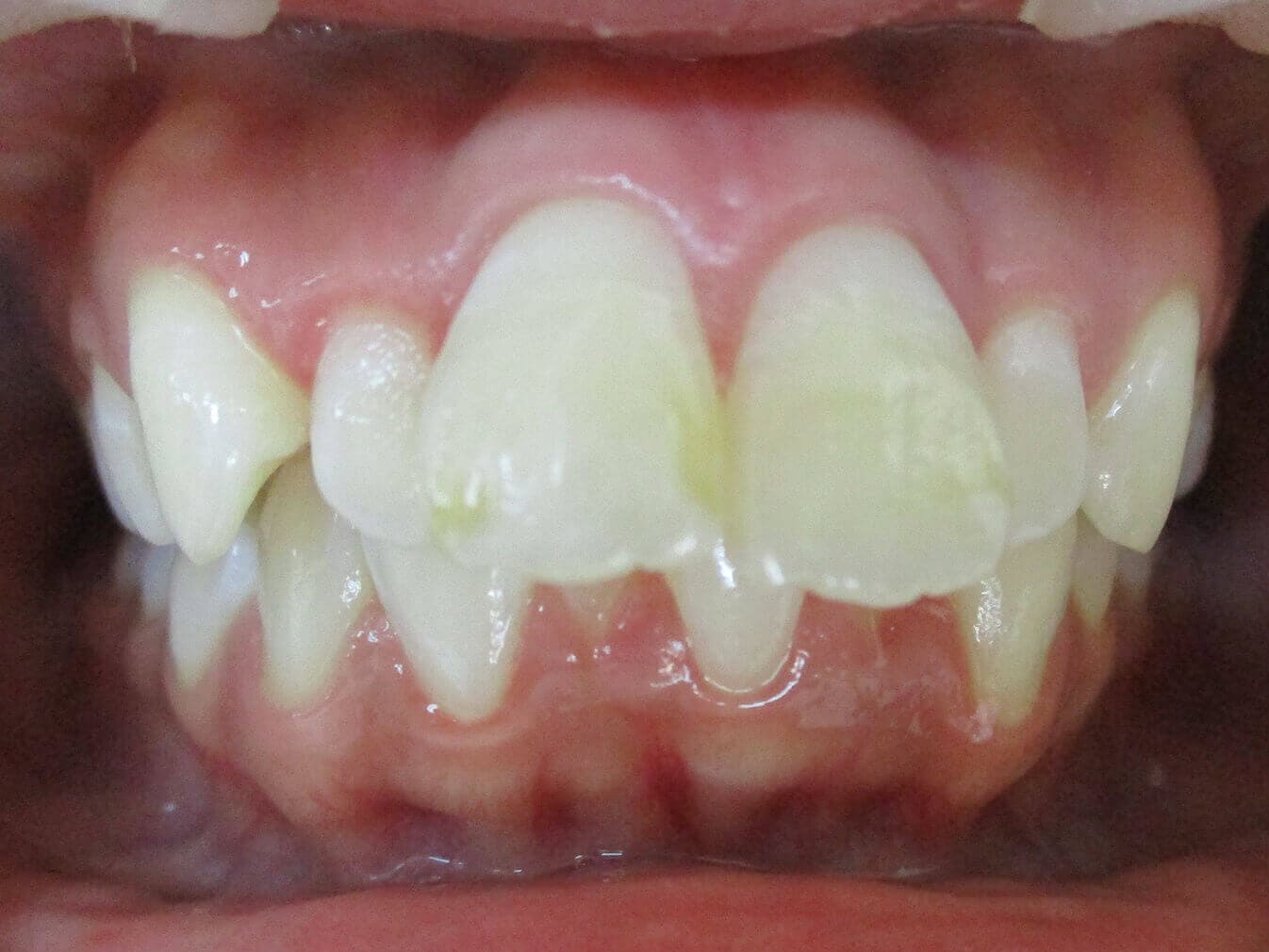 Before