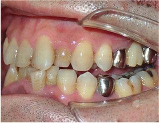 Before