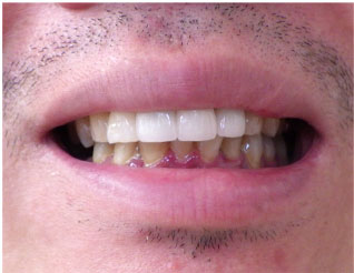 After