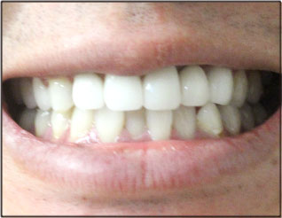 After