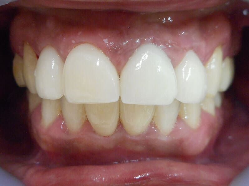 After