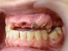 Before