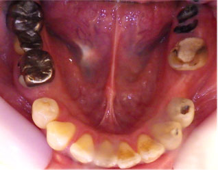 Before