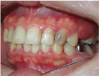 Before