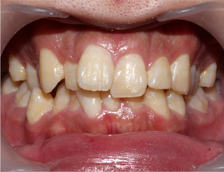 Before