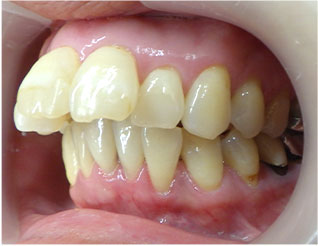 Before
