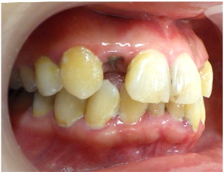 Before
