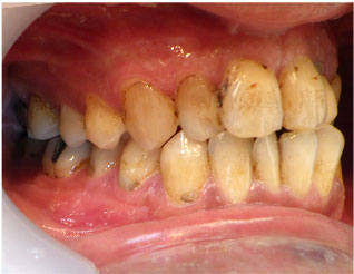 Before