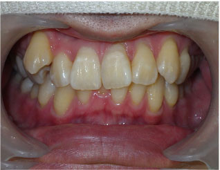Before