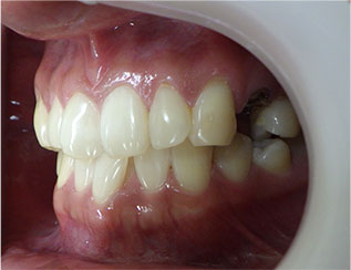 Before
