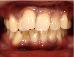 Before