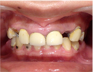 Before