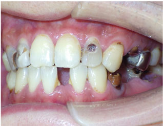 Before