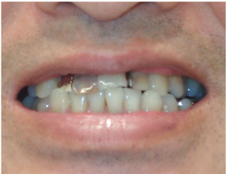 Before