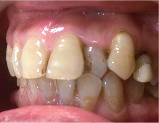 Before