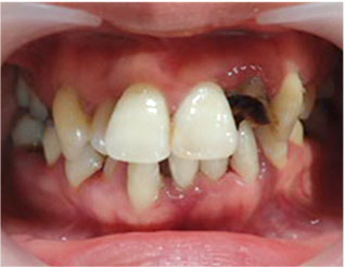 Before