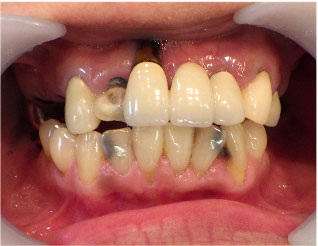 Before