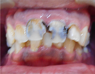 Before