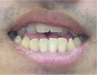 Before