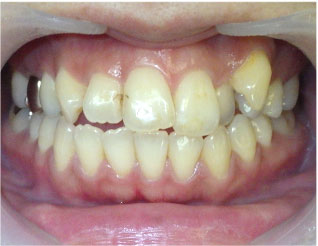 Before