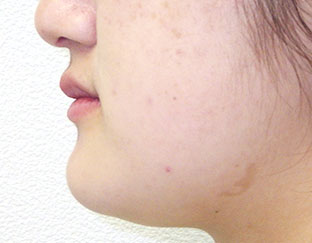 After
