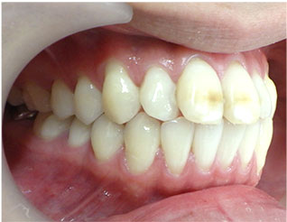 Before