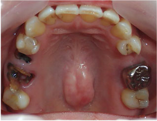 Before