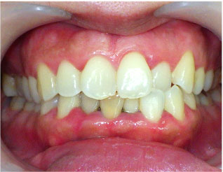 Before