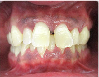 Before