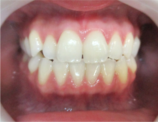 Before