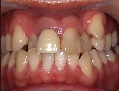 Before