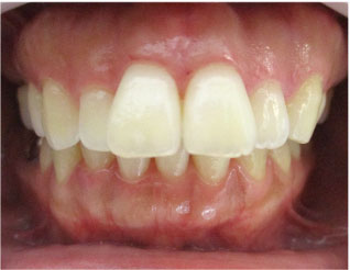 Before