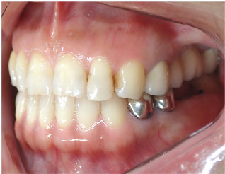 After