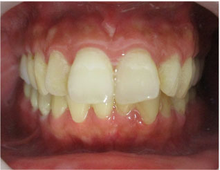 Before
