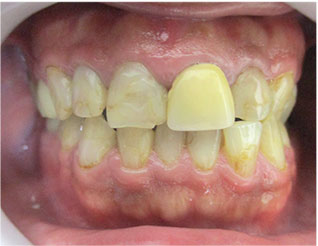 Before