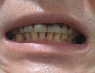 Before