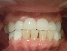 After