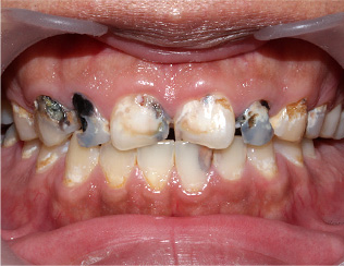 Before