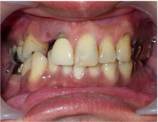 Before