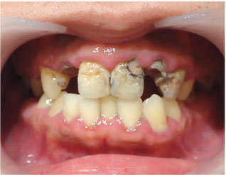Before