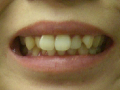 Before