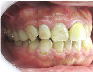 Before