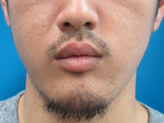 After
