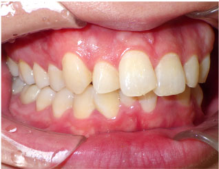 Before