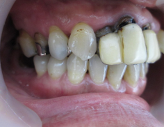 Before