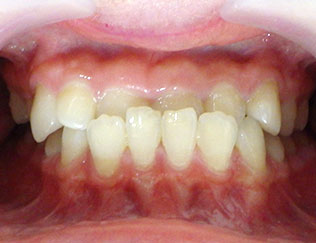 Before
