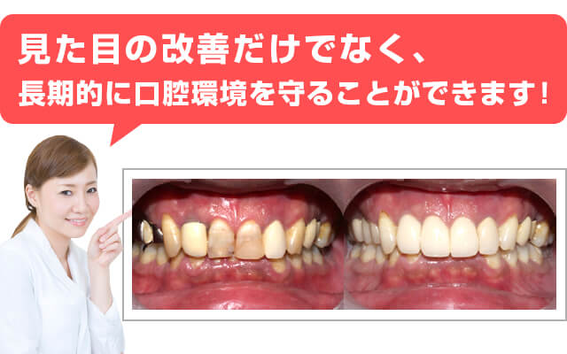 見た目の改善だけでなく、長期的に口腔環境を守ることができます