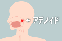 後天的な原因 耳鼻科の病気